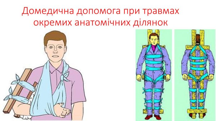 Домедична допомога при травмах: що робити при пошкодженнях?