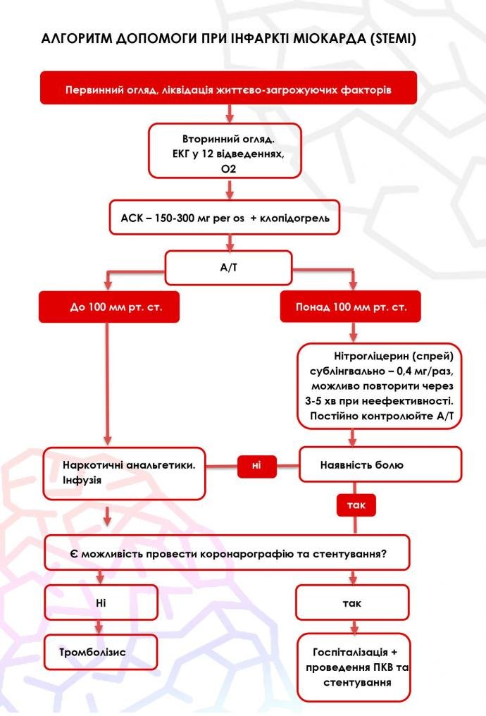 Невідкладна допомога при інфаркті міокарда: алгоритм дій крок за кроком