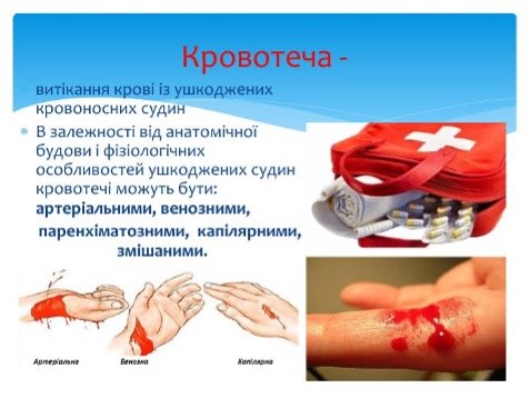 Перша медична допомога при кровотечах: що потрібно знати?