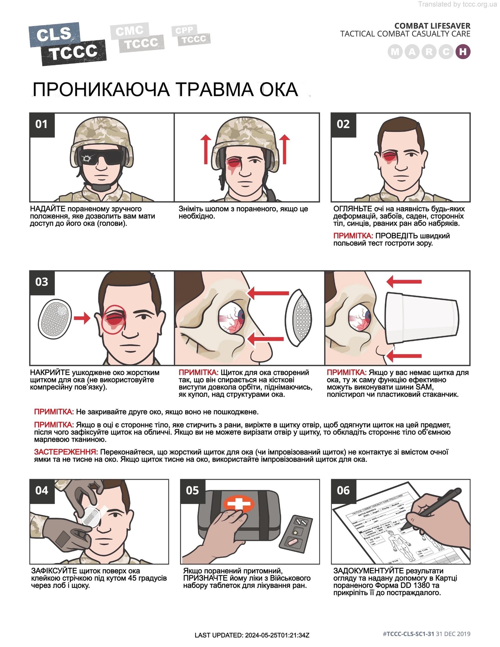 Як надати першу допомогу при травмі ока: ефективні поради