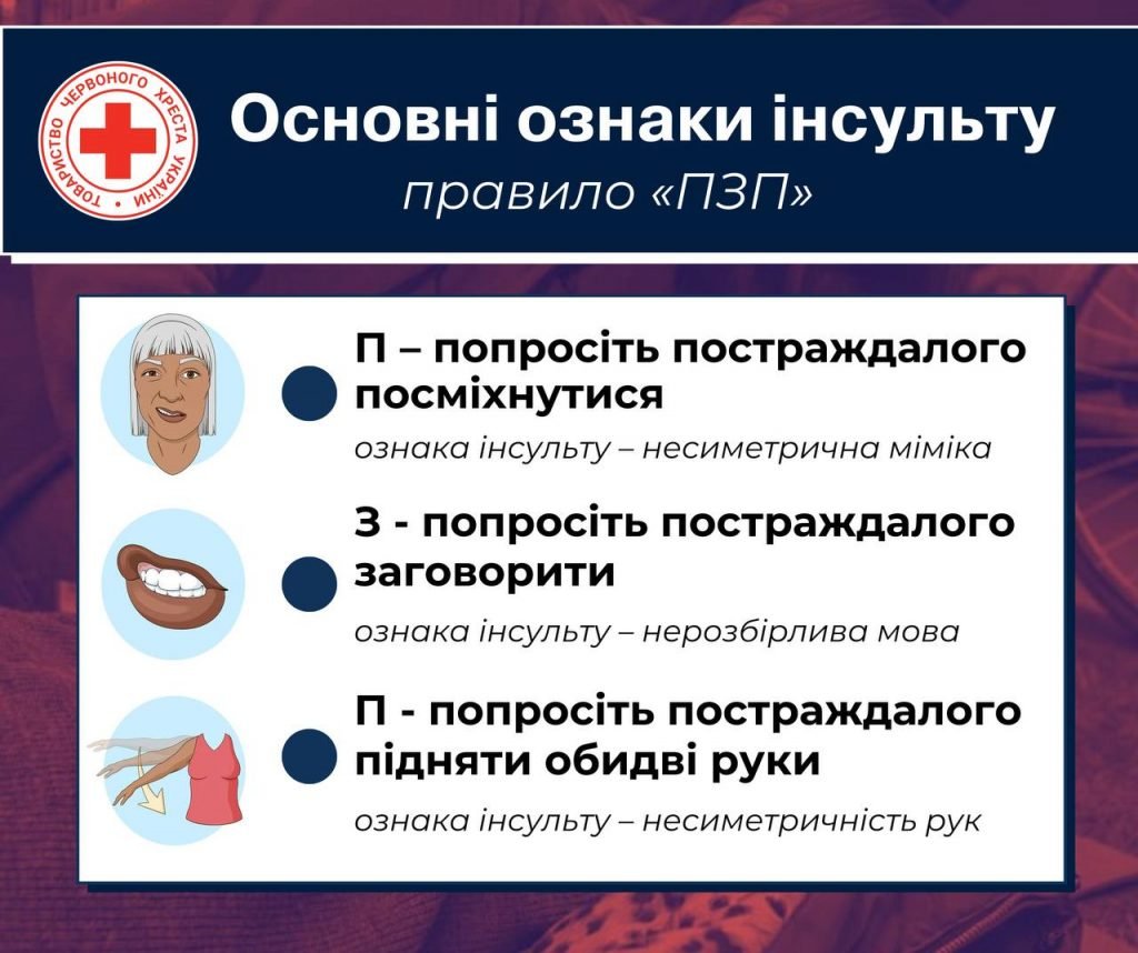 Перша допомога при інсульті: що робити негайно для порятунку?