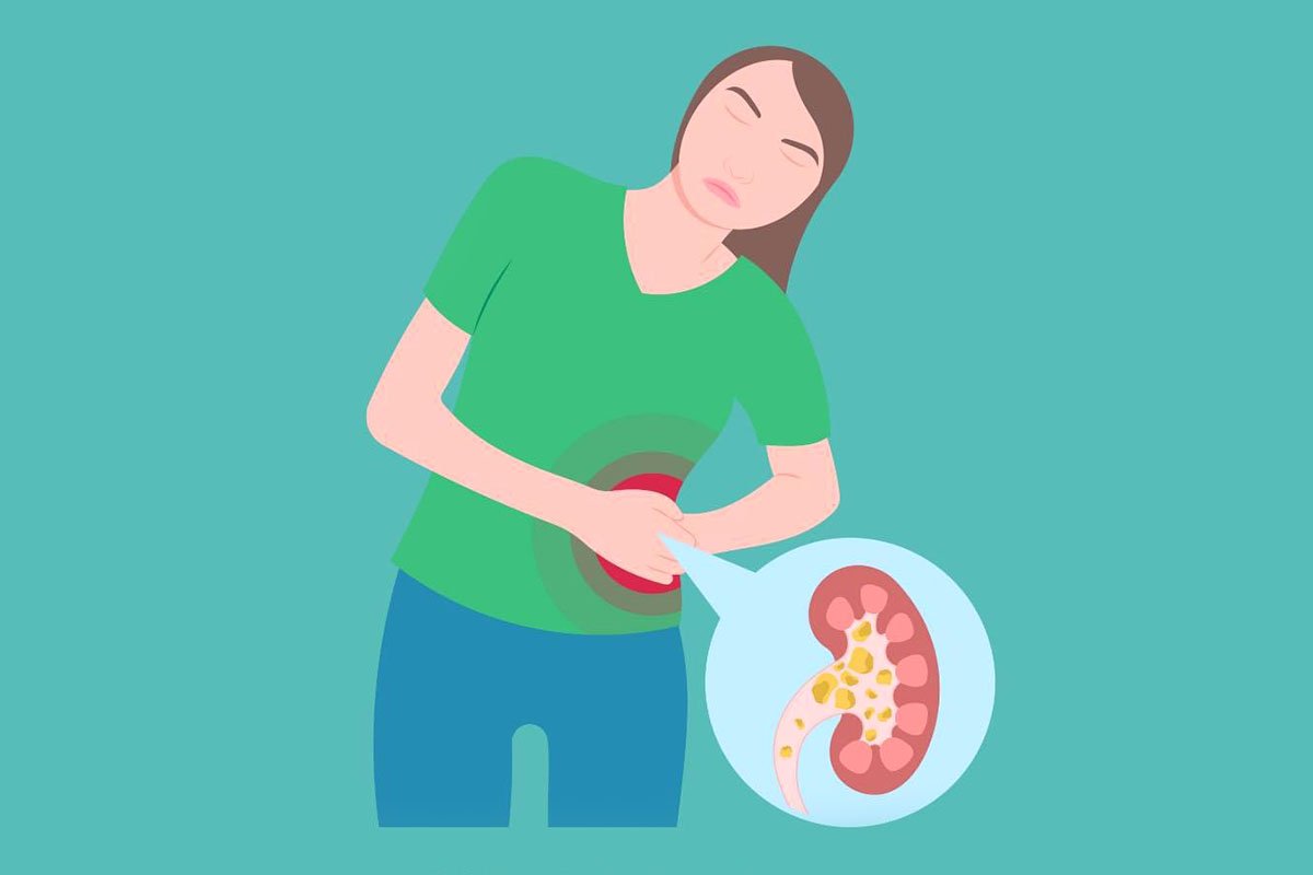 Невідкладна допомога при нирковій коліці: ефективні методи та поради