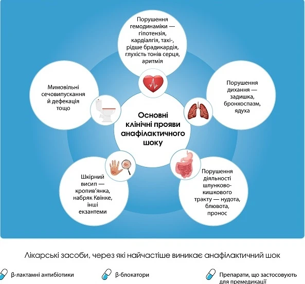 Як надати першу допомогу при анафілактичному шоці: поради спеціалістів
