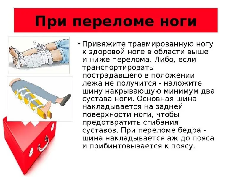 Як надати першу допомогу при пробитті ноги: повний гайд