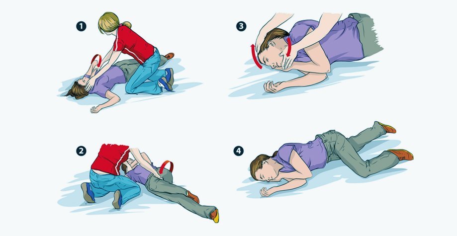 Як надати першу допомогу при епілепсії: інструкція та поради