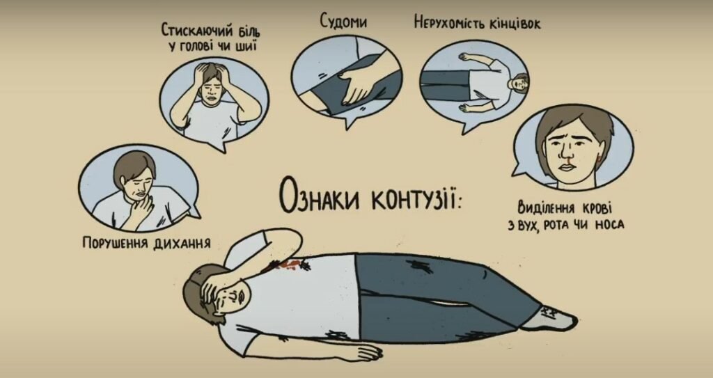 Перша допомога при контузії: як правильно діяти в екстрених умовах