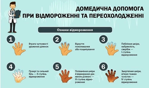 Як надати першу медичну допомогу при обмороженні: поради та дії