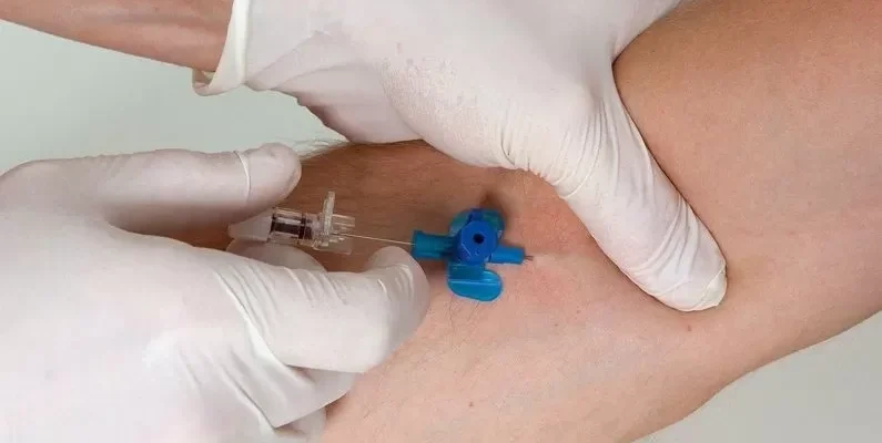 Чи можна згинати руку з катетером: рекомендації та поради лікарів