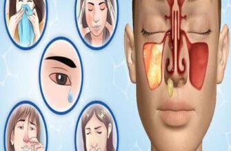 Наслідки гаймориту: як нездужання впливають на ваше здоров’я