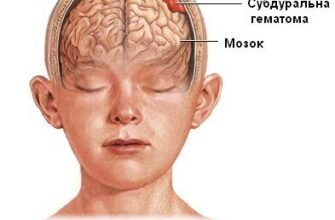 Гематома голови: наслідки та вплив на здоров’я людини