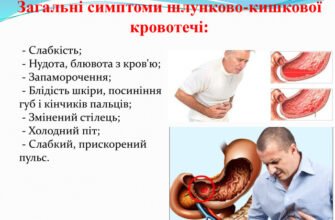 Шлунково-кишкова кровотеча: ефективна перша допомога і поради
