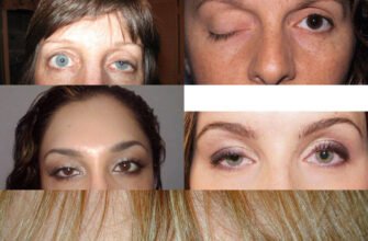 Негативні наслідки ботоксу: ризики та ускладнення косметичної процедури