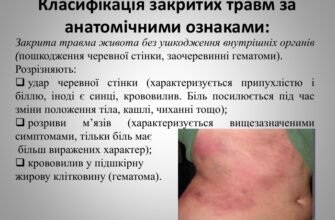 Удар в живіт: наслідки та ризики для вашого здоров’я