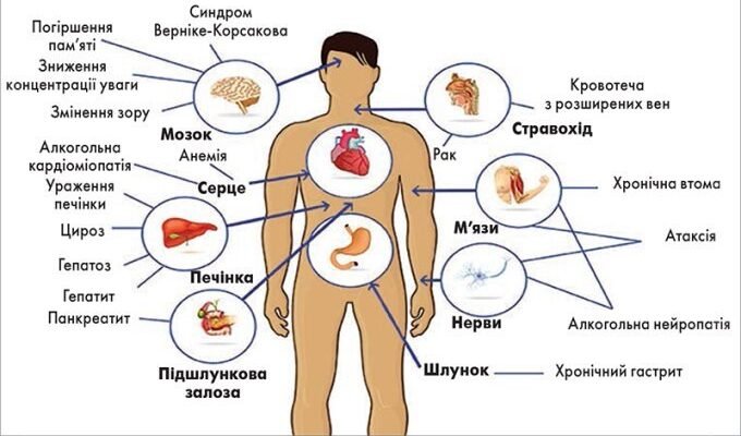 Наслідки вживання алкоголю: вплив на здоров’я та соціальні проблеми