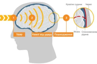 Удар по голові: наслідки та як вберегтися від травмуючих ефектів