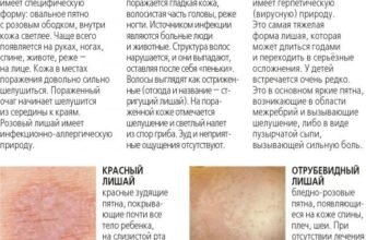 Чи можна мочити лишай: поради з догляду за шкірою при захворюванні