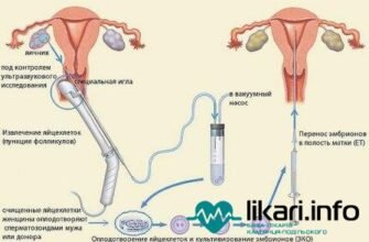 Наслідки після пункції яєчників: що варто знати для відновлення