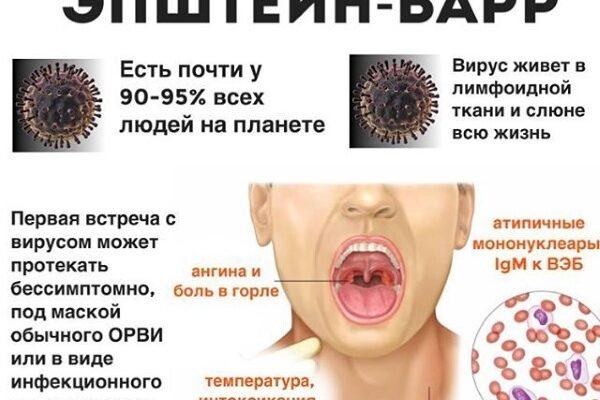 Вірус Епштейна-Барр: наслідки та вплив на здоров’я людини
