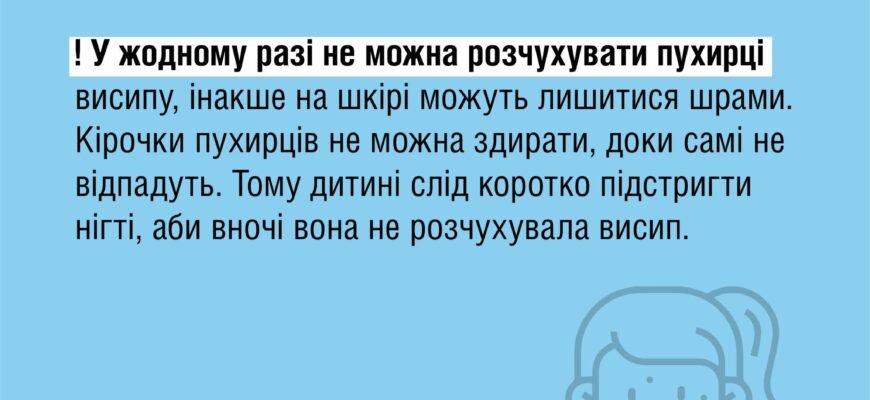 Чи можна захворіти вітрянкою вдруге: міф чи реальність? Чи можна захворіти вітрянкою вдруге: міф чи реальність?