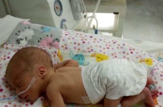 Пневмонія у новонароджених: наслідки та шляхи їх подолання