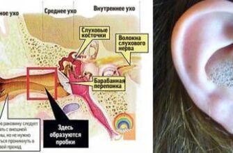 Чи можна капати вухо перекисом водню: поради та застереження