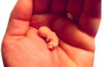 Наслідки абортів: вплив на здоров’я жінки та психоемоційний стан