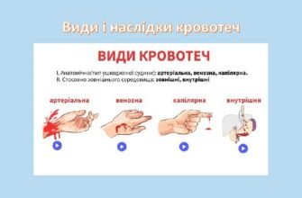 Види і наслідки кровотеч: розглядаємо основні категорії та ризики