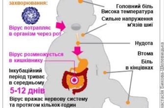Щеплення від поліомієліту: наслідки та важливість вакцинації для здоров’я