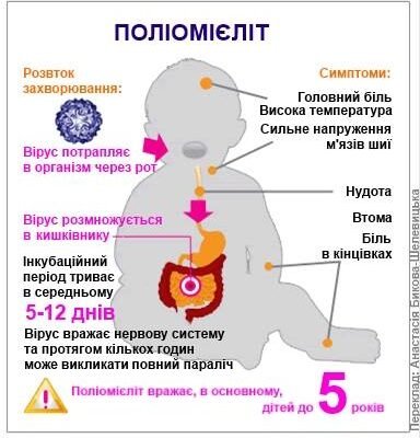 Переваги та наслідки щеплення від поліомієліту: що варто знати