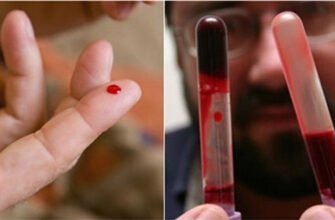 Густа кров: наслідки для здоров’я та як їх уникнути