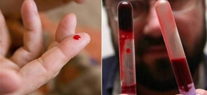 “Густа кров: наслідки для організму та як уникнути ризиків”