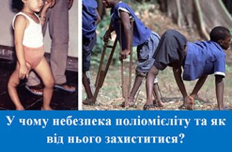 Поліомієліт: наслідки, які варто знати для здоров’я вашої дитини