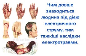 Наслідки ураження електричним струмом: загрози та відновлення