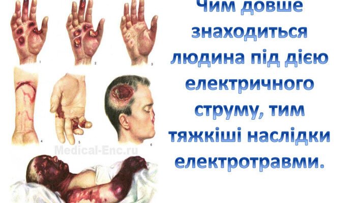Наслідки ураження електричним струмом: загрози та відновлення