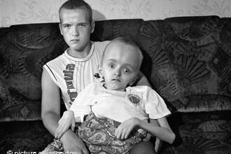 Наслідки Чорнобильської катастрофи для здоров’я людей: Основні проблеми