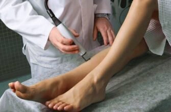 Наслідки лазерного лікування вен: що варто знати перед процедурою