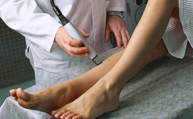 Наслідки лазерного лікування вен: що варто знати перед процедурою