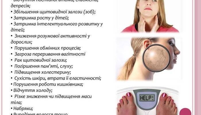 Наслідки йододефіциту: вплив на здоров’я і вирішення проблеми