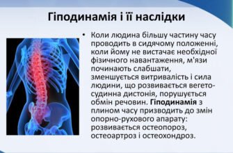 Гіподинамія: наслідки для здоров’я та як запобігти небезпекам