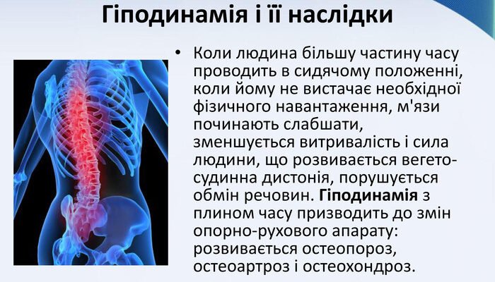 Гіподинамія: наслідки для здоров’я та як запобігти небезпекам