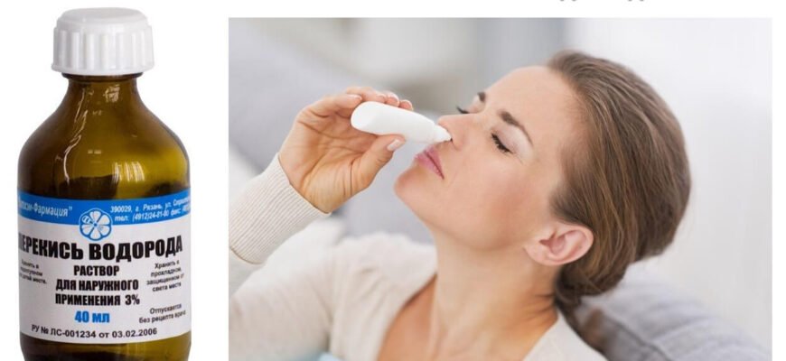 Чи можна промивати ніс перекисом водню: поради та застереження