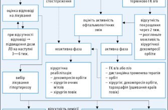 Чи можна вилікувати дифузний токсичний зоб: актуальні методи лікування