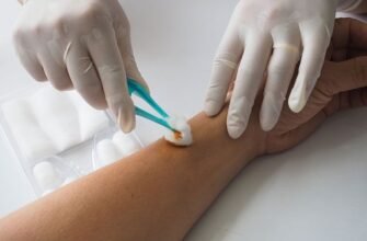 Чи можна застосовувати Бетадин на відкриту рану: рекомендації та ризики