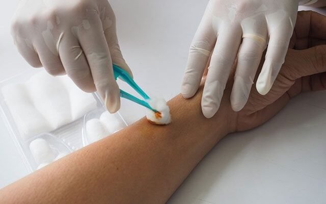 Чи можна застосовувати Бетадин на відкриту рану: рекомендації та ризики