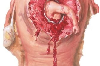 Наслідки розриву шийки матки: що потрібно знати для здоров’я