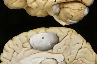 Кіста головного мозку: наслідки та вплив на здоров’я людини