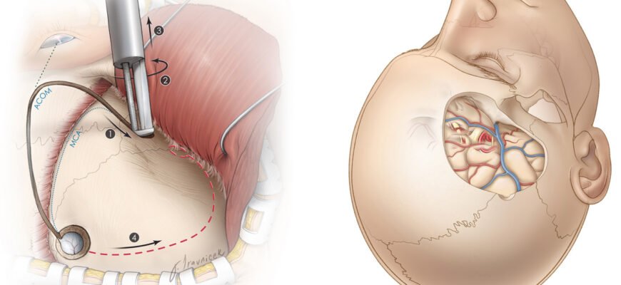 Вплив трепанації черепа: наслідки та відновлення після процедури