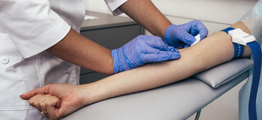 Оптимізований заголовок для статті:

“Чи можна їсти перед МРТ з контрастом: важливі рекомендації”