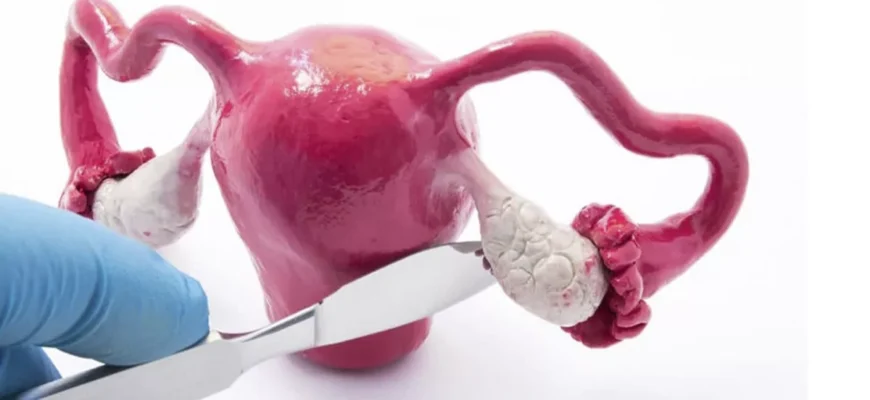 Наслідки після видалення двох яєчників: як змінюється організм?