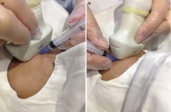 Які наслідки можливі після видалення паращитовидних залоз?